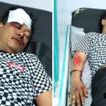 Foto : Widhi mengalami Kecelakaan dan sedang di rawat di rumah sakit